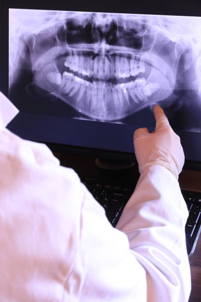 Best Emergency Tooth Extraction  in Kettering, MD