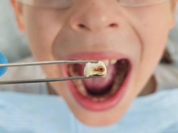 Best Urgent Tooth Repair  in Kettering, MD