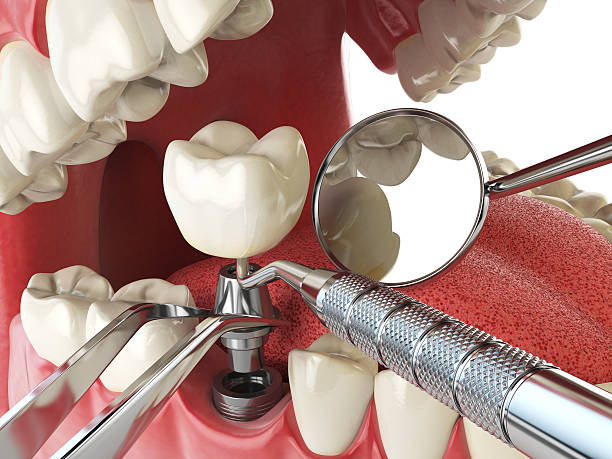 Best Emergency Gum Pain Relief  in Kettering, MD